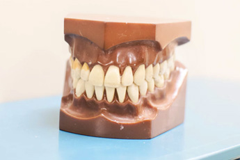 Почему стирается зубная эмаль?